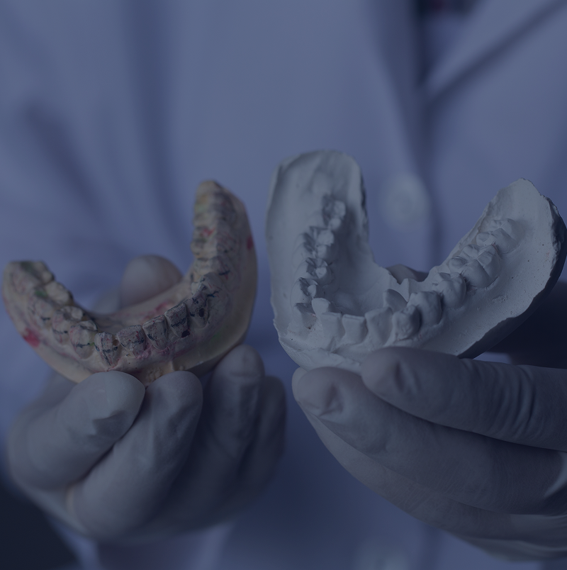 Dentist displaying dental impressions