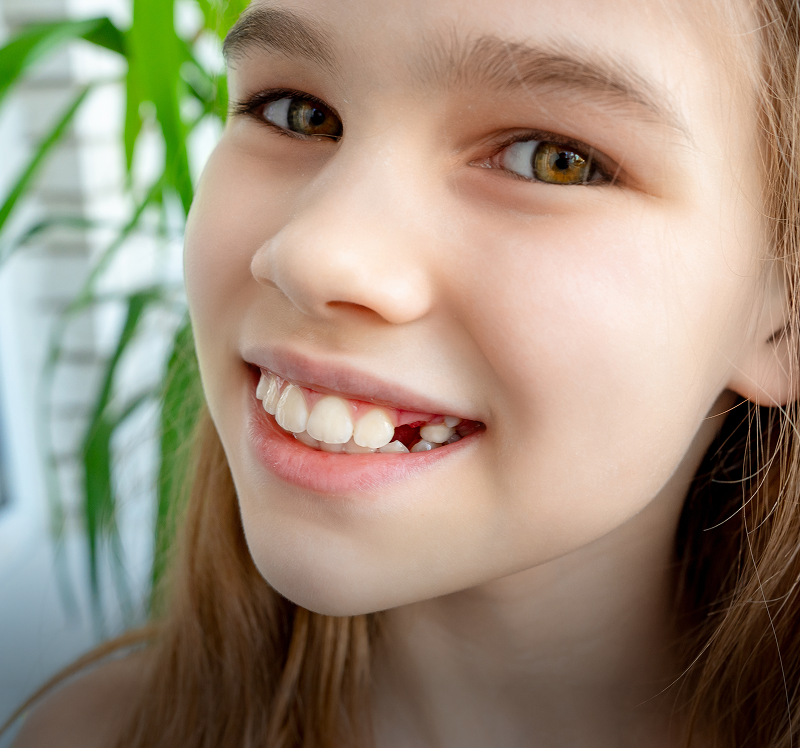 Happy child showing lost tooth gap