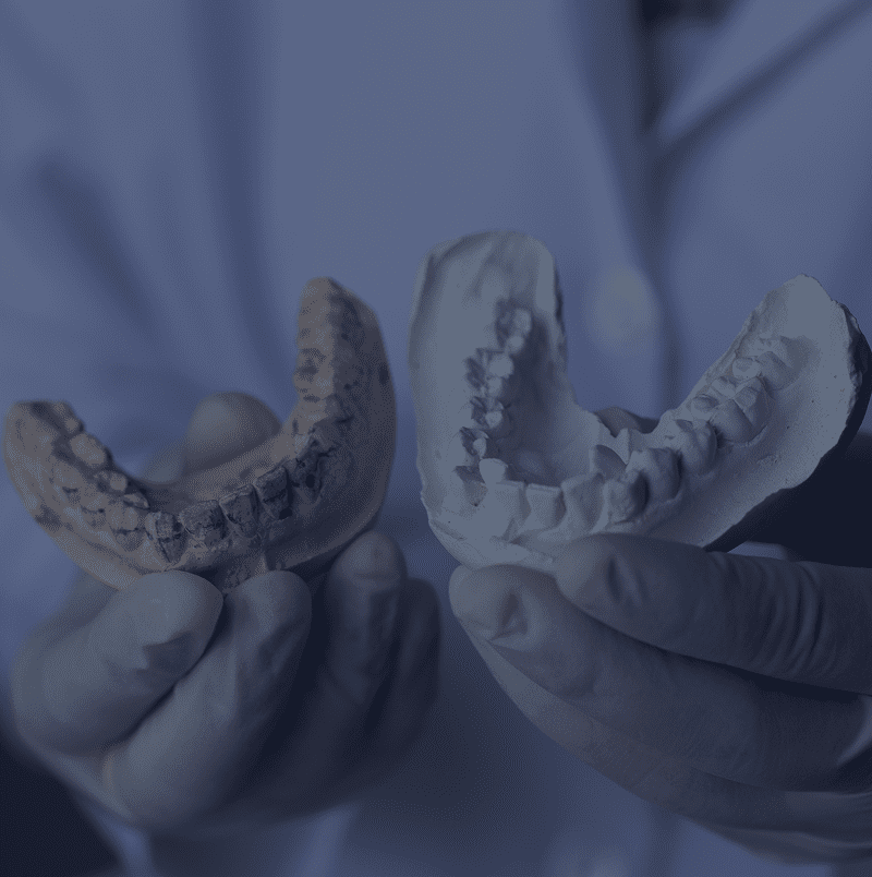Dentist displaying dental impressions